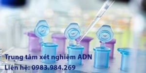 Trung Tam Xet Nghiem Adn Bac Kan, Xet Nghiem Adn O Bac Kan, Xet Nghiem Adn Gia Re, Xet Nghiem Adn Thai Nhi O Bac Kan, Xet Nghiem Adn Cha Con O Bac Kan, Xet Nghiem Adn Lam Giay Khai Sinh O Bac Kan
