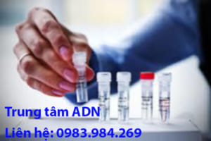 Trung Tam Xet Nghiem Adn Gia Re, Chinh Xac Tuyet Doi, Tra Ket Qua Nhanh Chong, Xet Nghiem Adn Huyet Thong Cha Con, Xet Nghiem Adn Thai Nhi