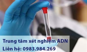 Trung Tam Xet Nghiem Adn Hai Duong, Xet Nghiem Adn O Hai Duong, Xet Nghiem Adn Gia Re, Xet Nghiem Adn Thai Nhi O Hai Duong, Xet Nghiem Adn Cha Con O Hai Duong, Xet Nghiem Adn Lam Giay Khai Sinh O Hai Duong