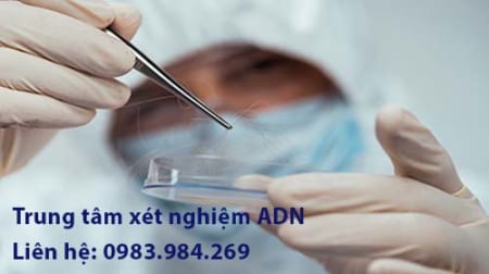 Xét nghiệm adn bằng tóc