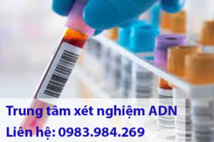 Cách xét nghiệm adn cha con tại Nam Định