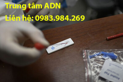 xet-nghiem-adn-lam-giay-khai-sinh-tai-soc-trang
