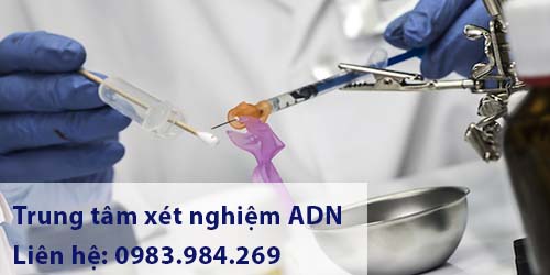 giam-dinh-adn-tai-lang-son